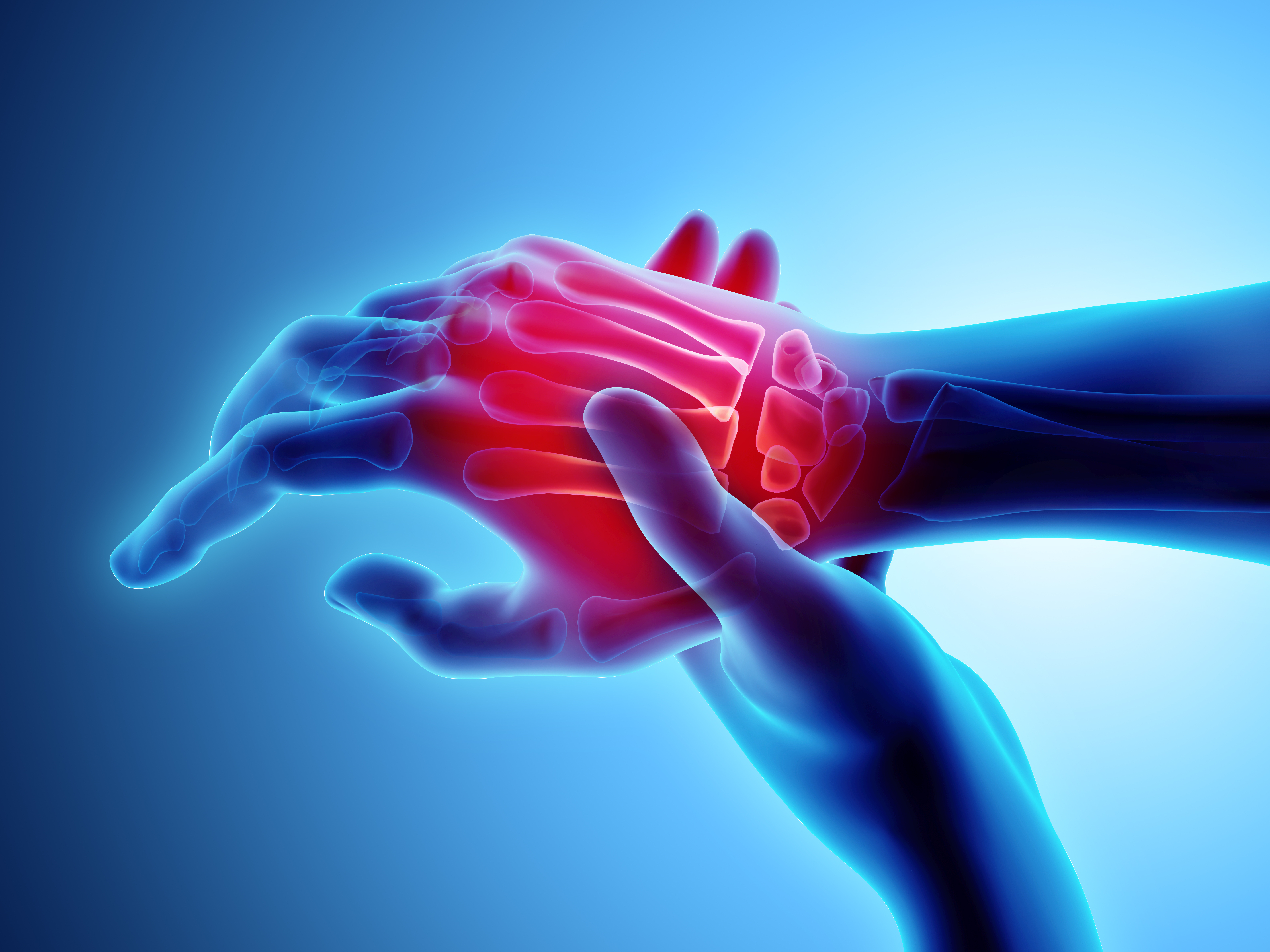 Hand Conditions