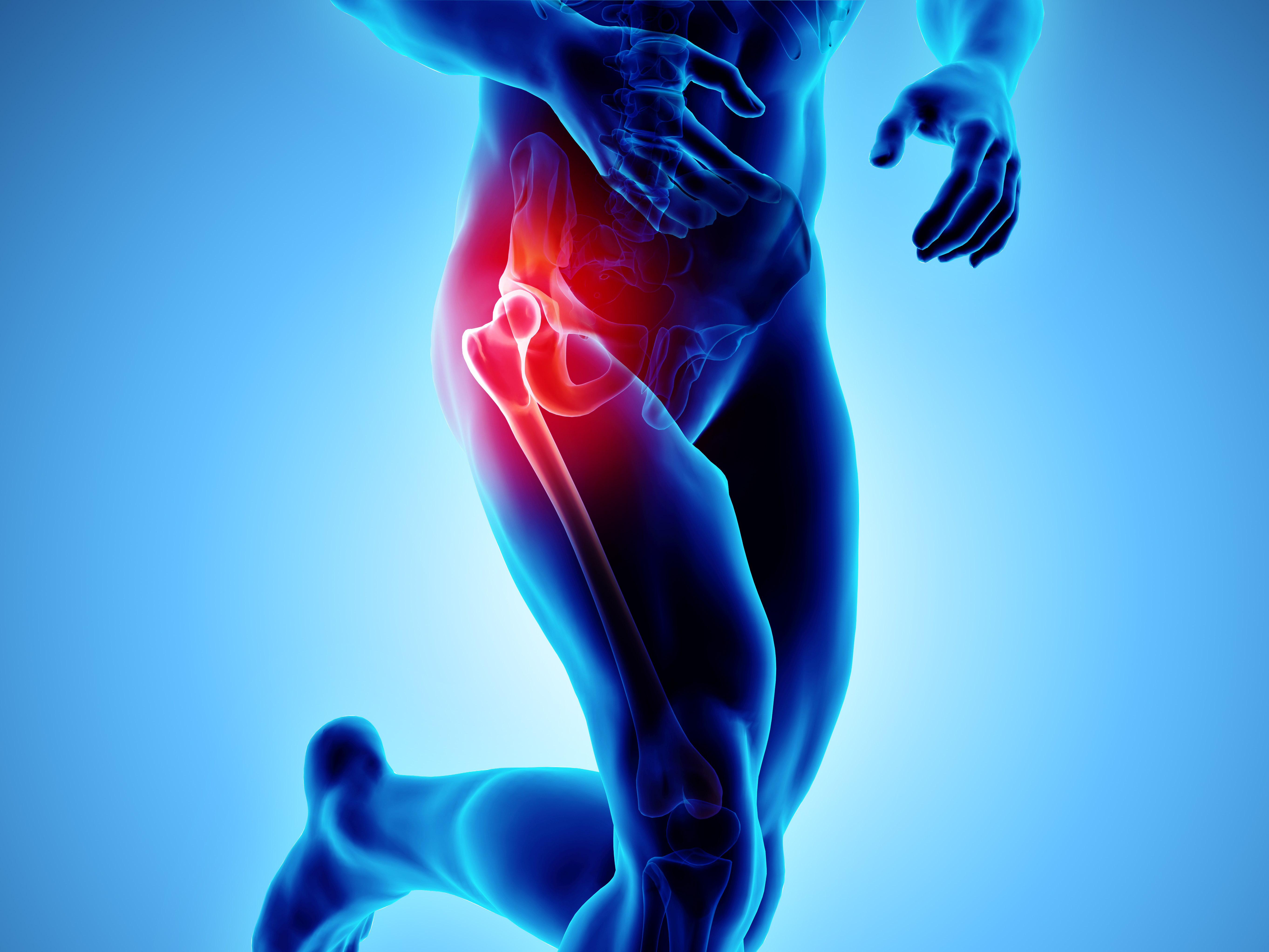 Hip Conditions