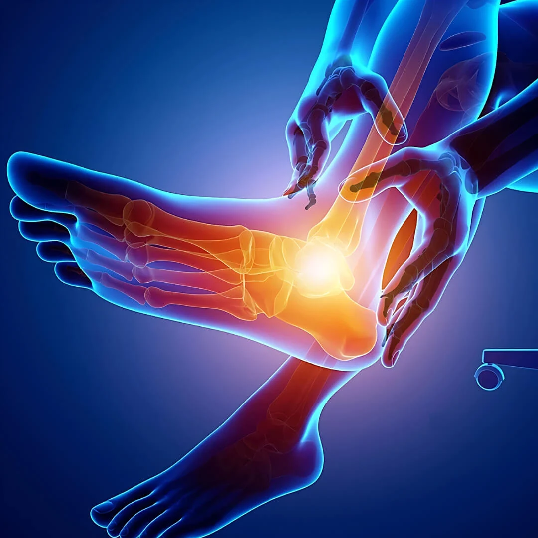Foot Conditions