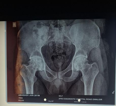 Happy patient